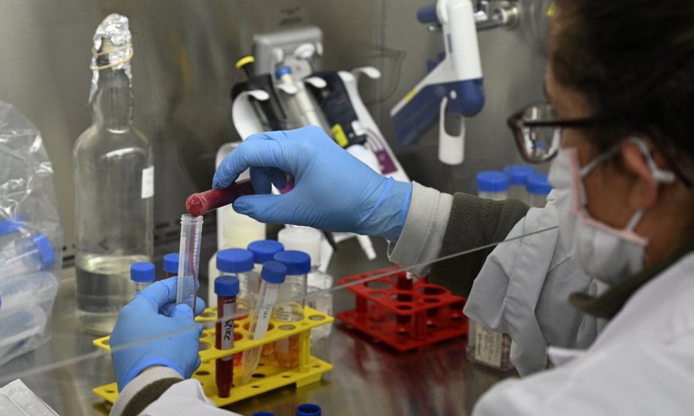 Vacina Astrazeneca oxford Unifesp