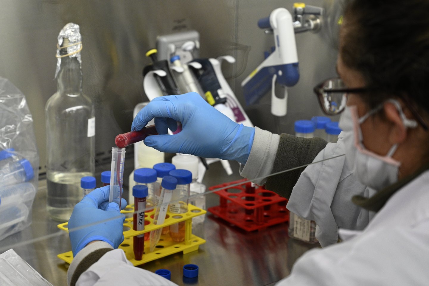 Vacina Astrazeneca oxford Unifesp