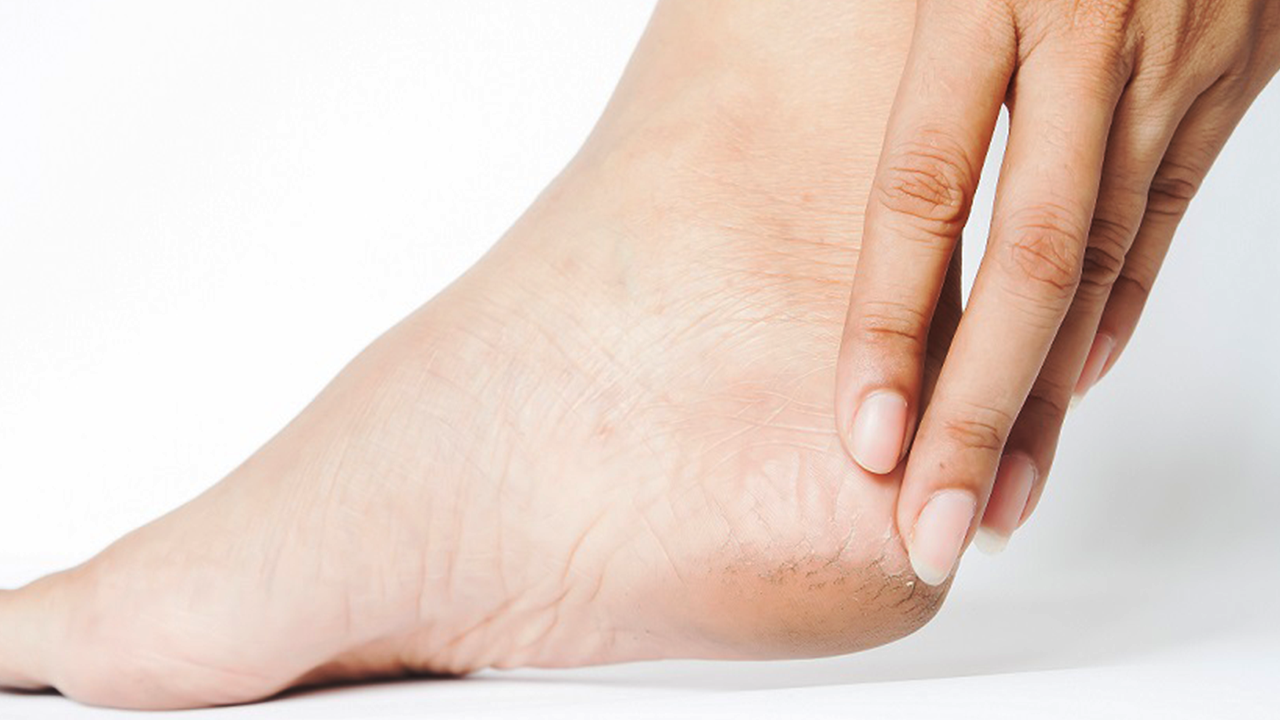 Dermatologista dá dicas de cuidados com a pele no tempo seco