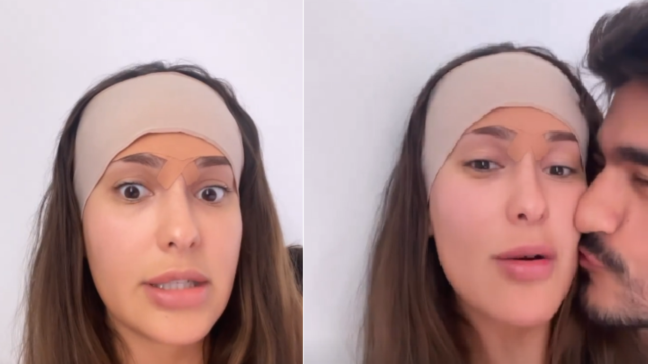 A ex-bbb compartilhou com seus seguidores algumas informações após passar por cirurgia; ela realizou um procedimento de redução de testa