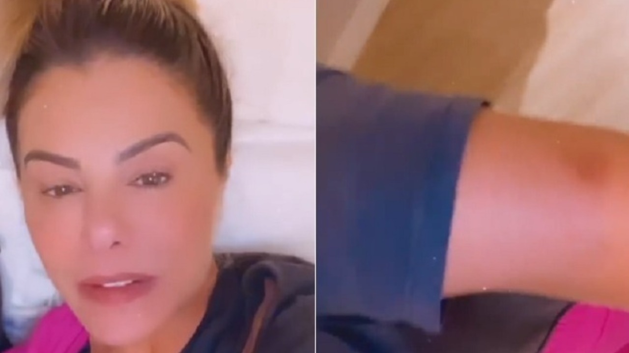 A esposa de Leonardo compartilhou com seus seguidores nas redes sociais sobre a vacina BCG, contra a tuberculose