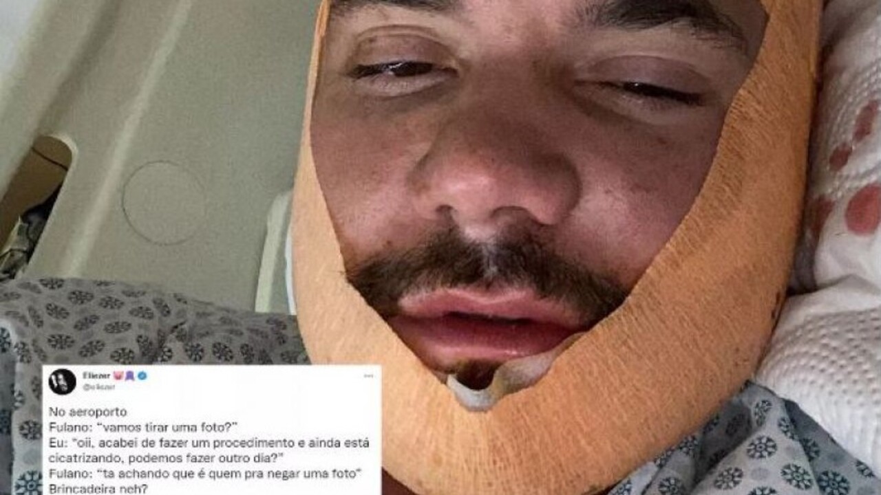 Retornando de Fortaleza, onde passou por um transplante de barba e cabelo, o ex-bbb comentou sobre o encontro com o fã