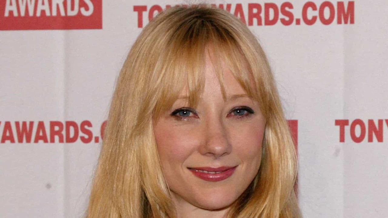 A atriz, que sofreu um acidente de carro na última sexta-feira (5), também apresenta queimaduras graves pelo corpo