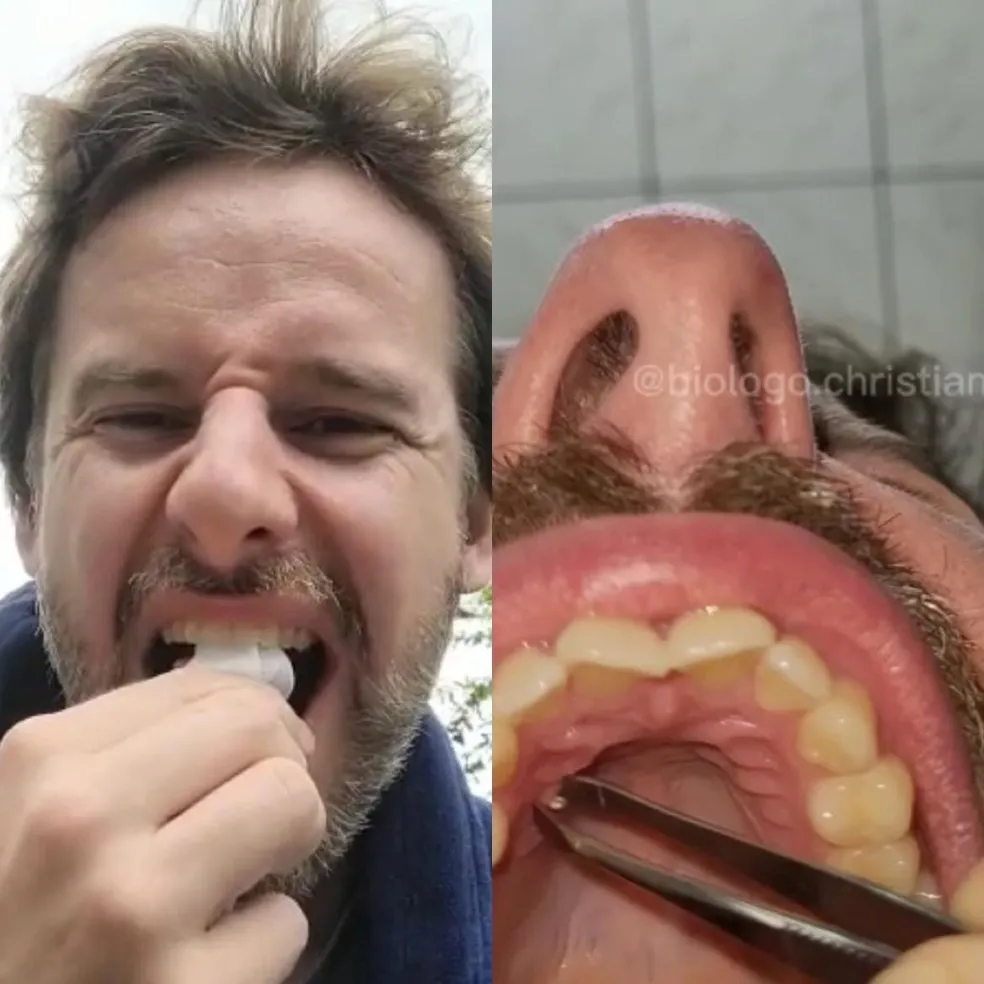 Veja o vídeo: Biólogo é picado no céu da boca por abelha