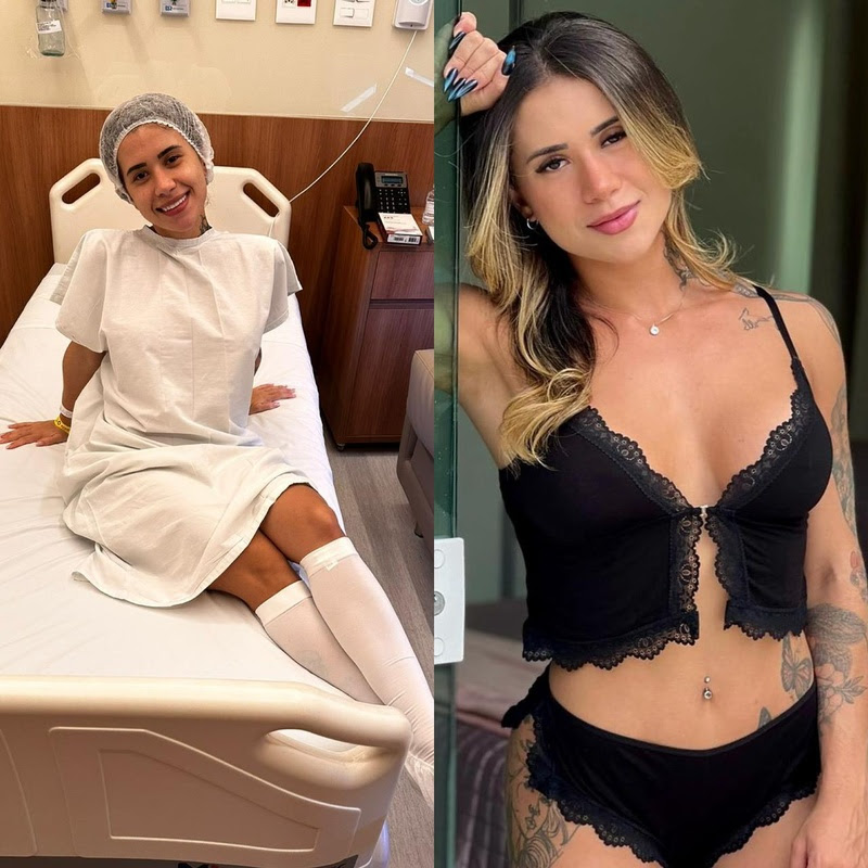 Atual Miss Bumbum, Larissa Sumpani, faz cirurgia de ninfoplastia