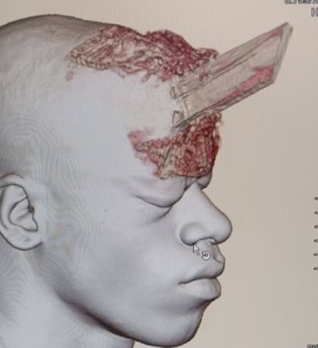 captura de tela 2024 07 11 073614