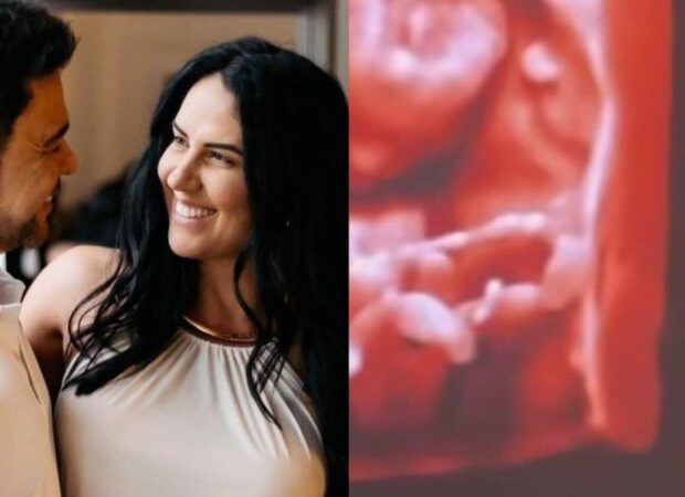 graciele lacerda ultrassom 1 widelg