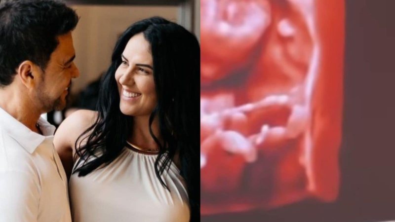 graciele lacerda ultrassom 1 widelg