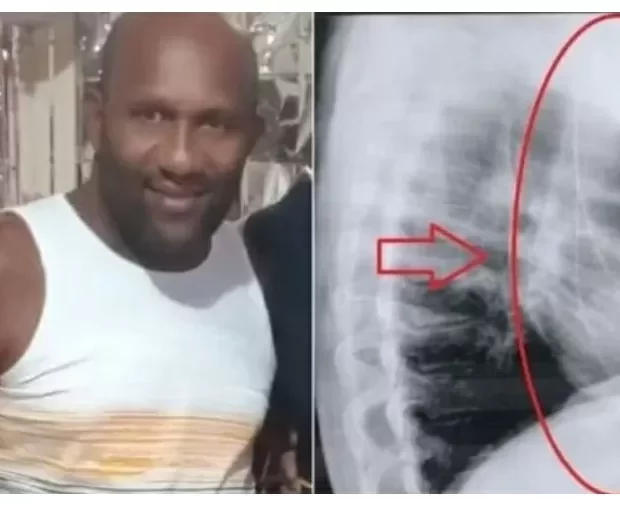 o incidente foi provocado por um erro medico 1721437778986 v2 900x506.jpg