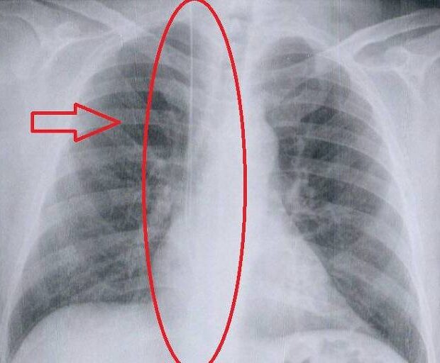 1721676528669eb2f0ae0b9 1721676528 3x2 md