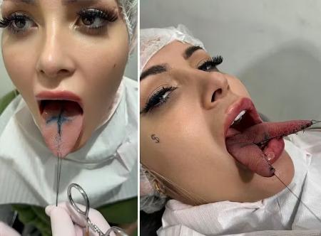 andressa urach faz bifurcacao na lingua 1722369660070 v2 450x1