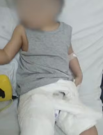 criança machucada na creche