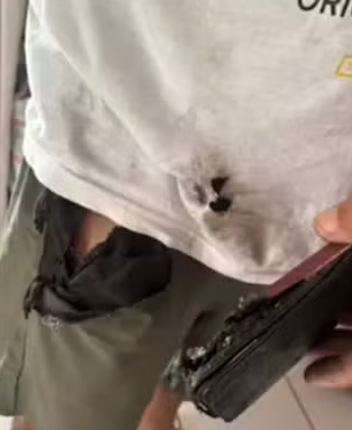 celular explode em bolso