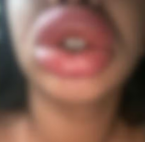 falsa biomédica é presa