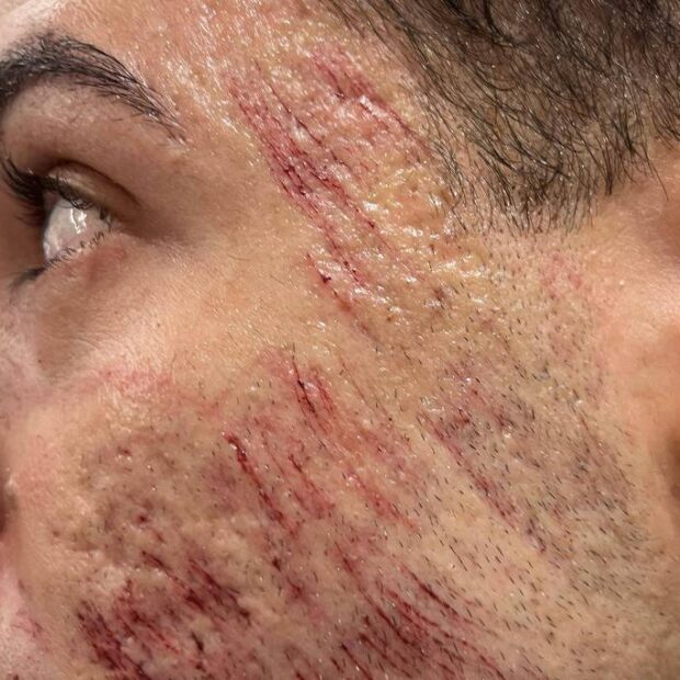 1719317343667ab35f1f5fe 1719317343 3x2 lg