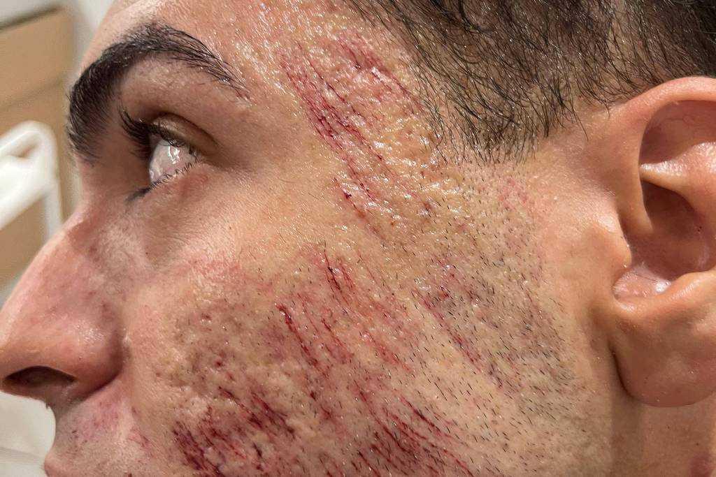 1719317343667ab35f1f5fe 1719317343 3x2 lg