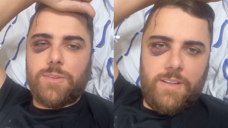 ze neto atualiza estado de saude apos acidente widelg