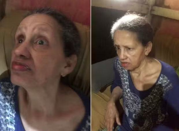 idosa luta por cirurgia no sus