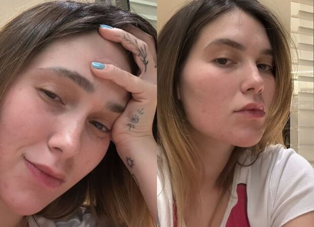 virginia fonseca podera tirar o silicone widelg