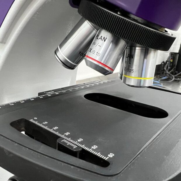 laboratório público de ceilândia adquire três novos microscópios ópticos