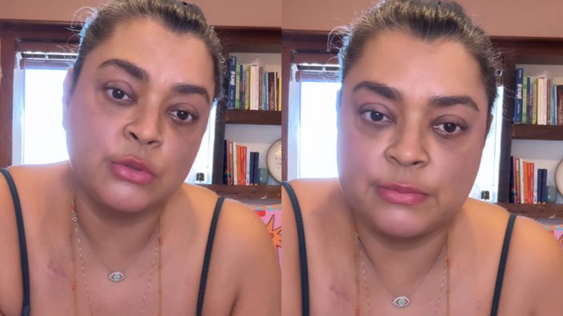 preta gil fala sobre quimioterapia widelg