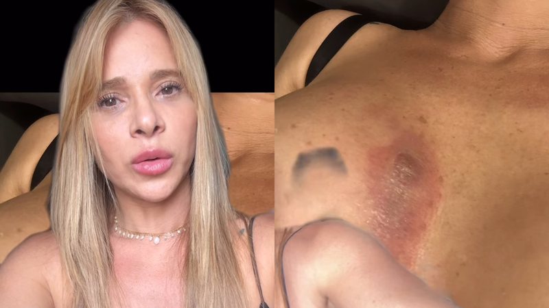 dany babaninha sobre nodulos nas mamas widelg