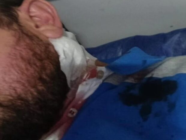 536e4f52786f659c2f94ad46b47b7d4e