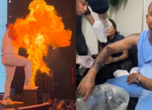 lesao grave fogo widelg