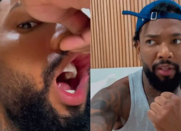 machucado nego do borel expoe detalhes de briga na rua achou que eu estava fugindo widelg