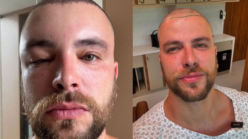 design sem nome 65 widelg