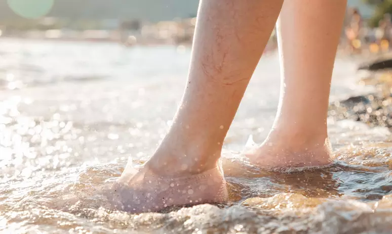 408852078 varizes verao