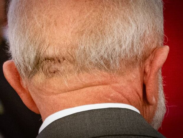 Nem mesmo estando hospitalizado o presidente da república deixou de cumprir com suas obrigações e preocupações como chefe de estado.