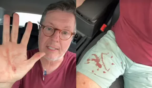 naom 677170a319ca4 zpt3xy