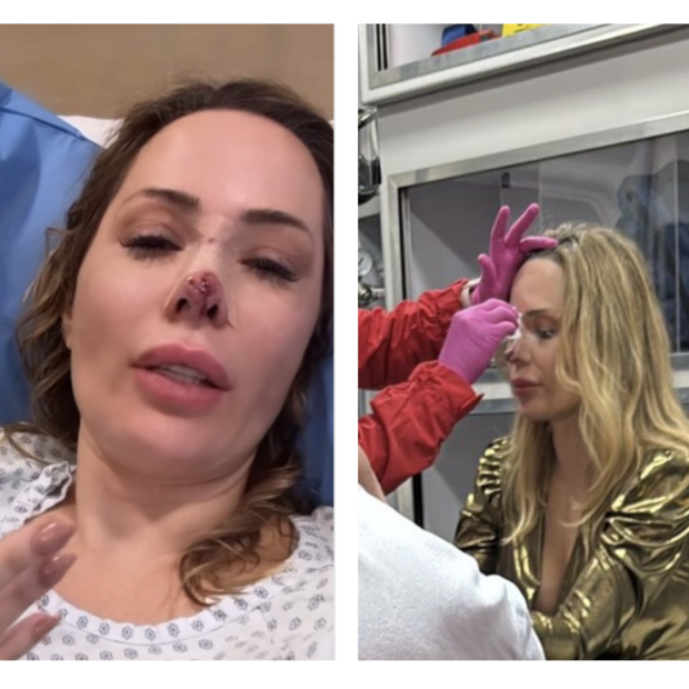 Influenciadora enfrenta pesadelo na festa de Ano Novo na Cidade do México e luta para reconstruir o nariz após ataque violento de um Akita Inu!