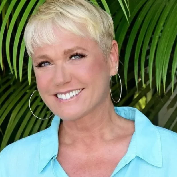 Rainha dos baixinhos faz artroscopia no joelho, mas não se preocupe: ela está bem!