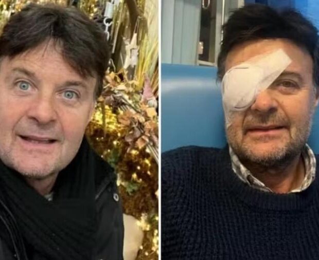 mike holoway fica cego de um olho 1737987614970 v2 900x506