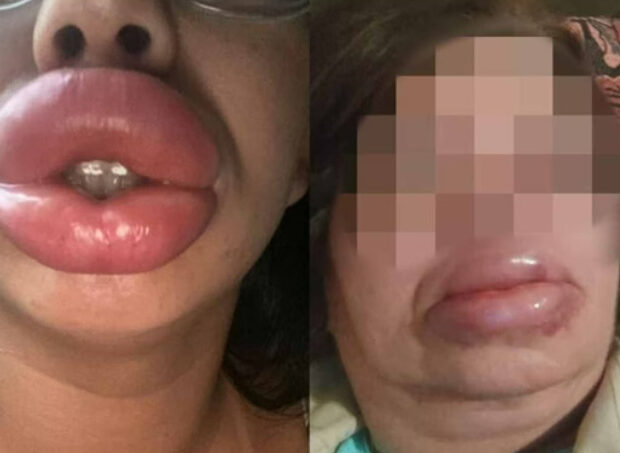 captura de tela 2025 03 24 070346