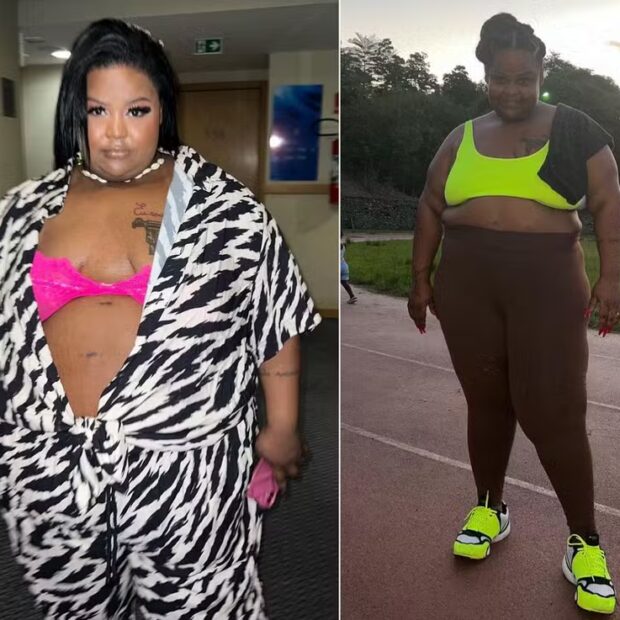 MC Carol compartilha sua jornada de emagrecimento e os desafios após a cirurgia bariátrica, incluindo complicações pós-lipoaspiração, em um relato sincero e emocionante.