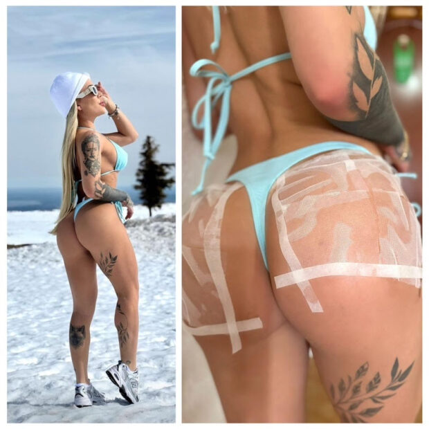 Caso extremo rendeu destaque na revista People e repercussão em países como Alemanha, Japão e Estados Unidos