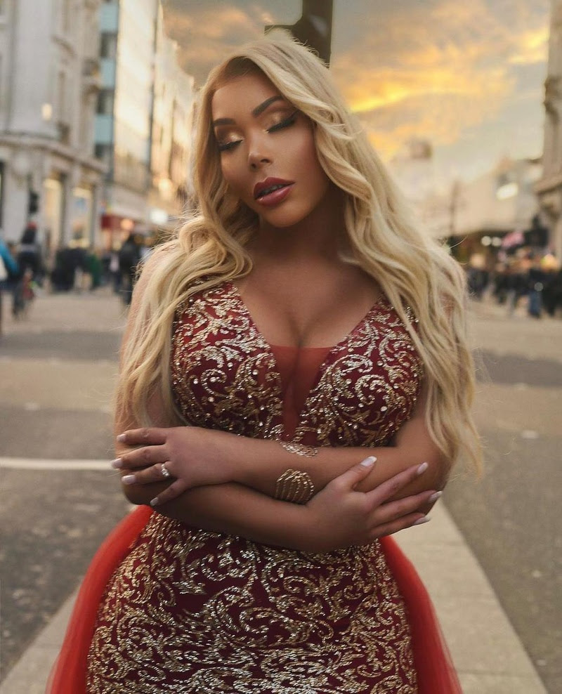 “Minha presença parecia algo a ser administrado”, desabafa Suellen Carey, que recusou o convite após ser posicionada entre os padrinhos.