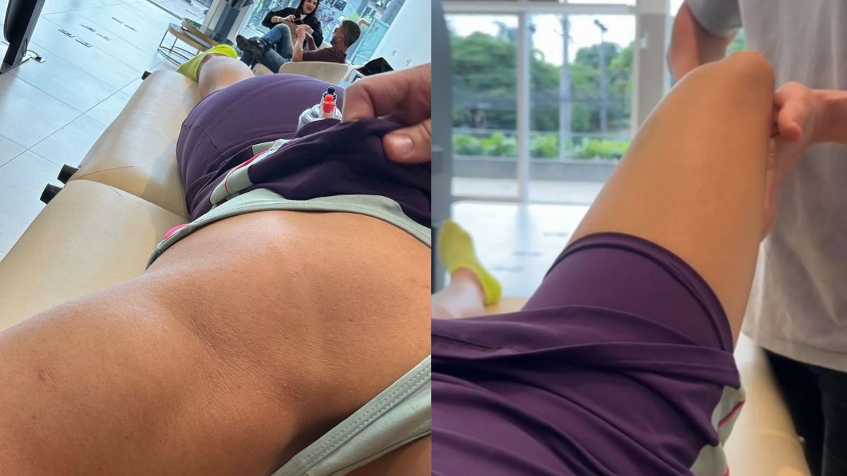A influenciadora compartilhou imagens do tratamento para se livrar da dor na lombar (Reprodução)