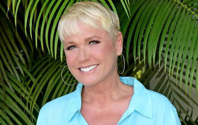 Recentemente a Rainha dos Baixinhos passou por um transplante capilar.