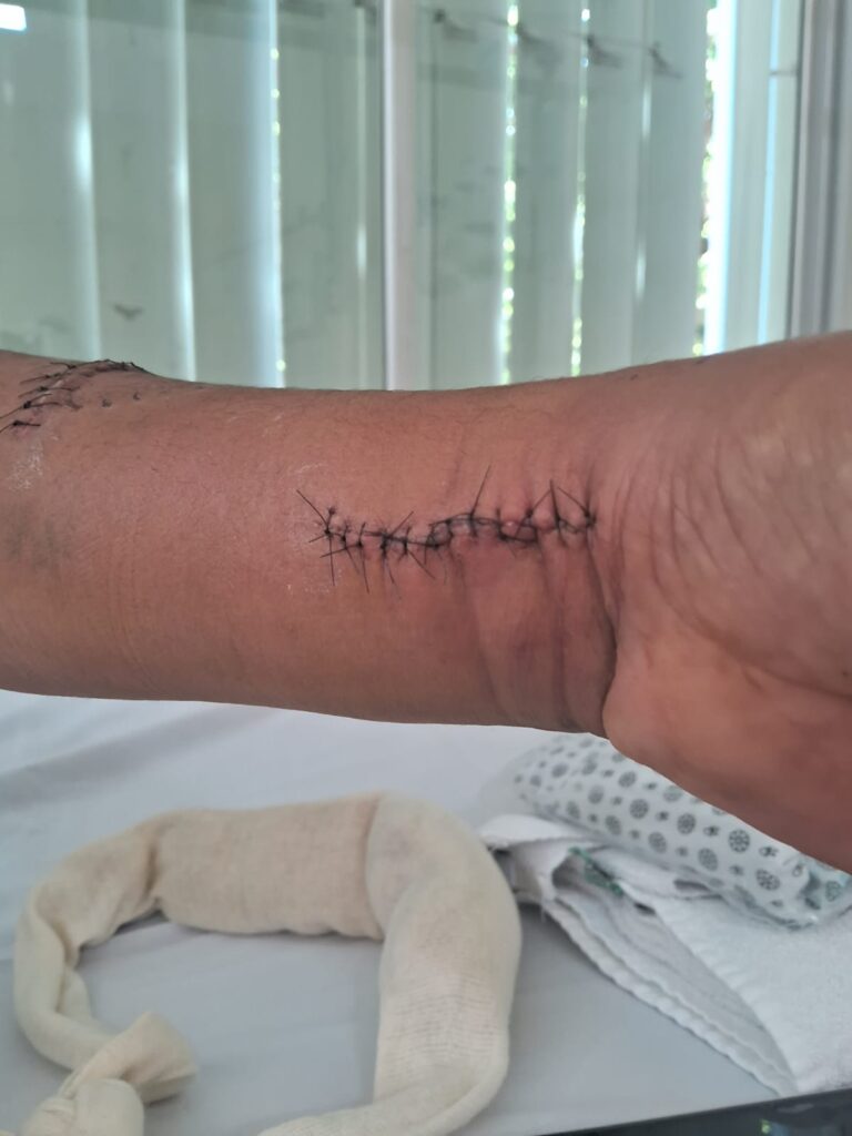 pintor é atacado por cães em mansão de influencer (2)