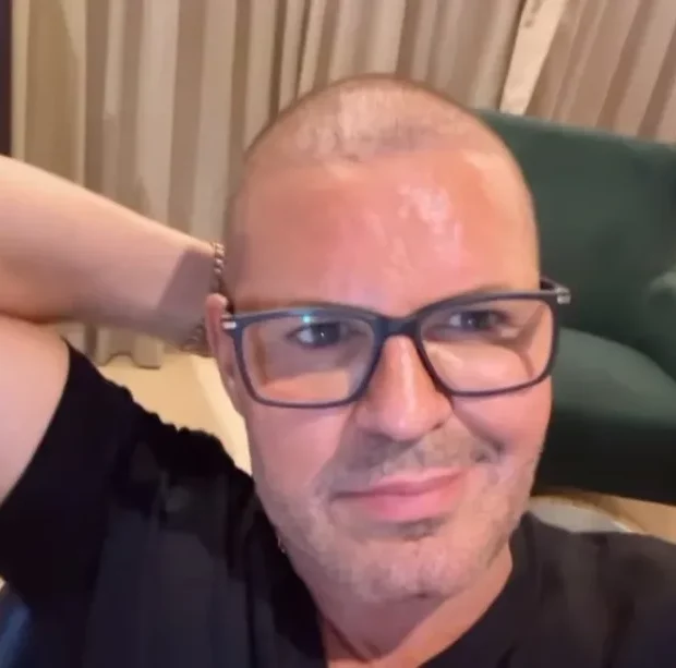 Após ser criticado por raspar a cabeça, o sertanejo explica seus motivos