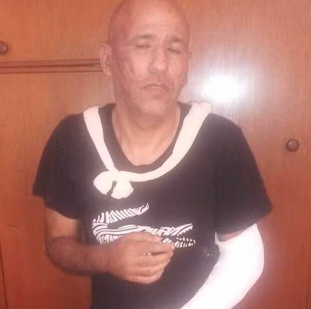 Caso polêmico se arrasta há dois anos, com direito a acusações, negações e até braço engessado