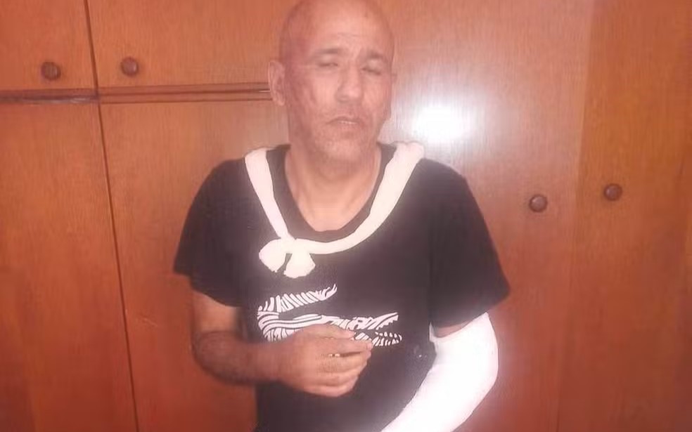 Caso polêmico se arrasta há dois anos, com direito a acusações, negações e até braço engessado