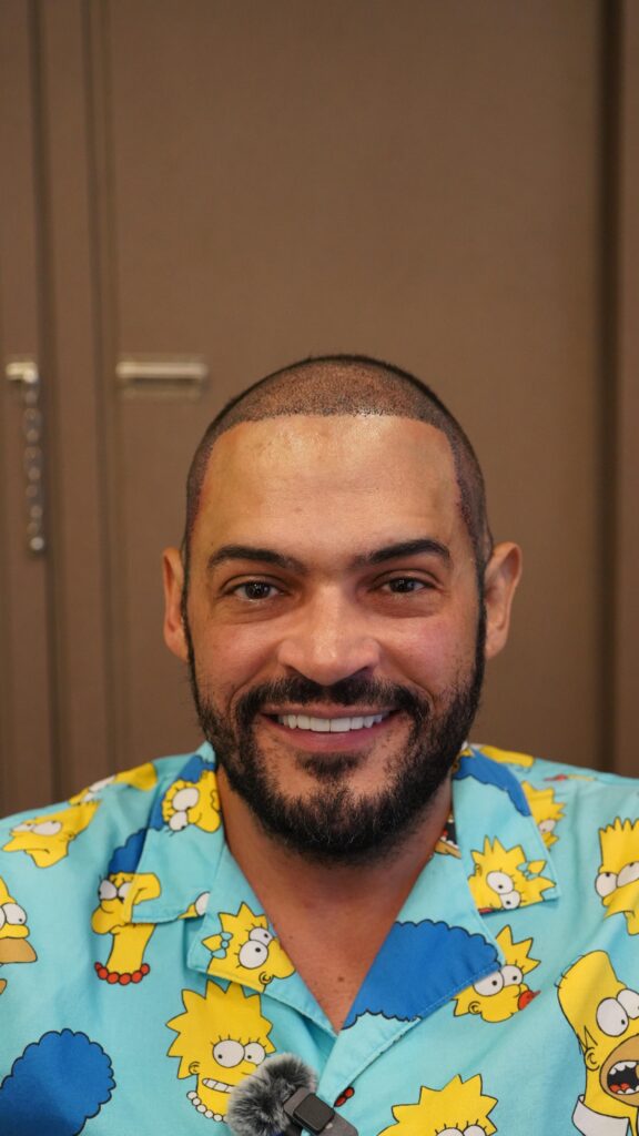 tc matheus ceara depois