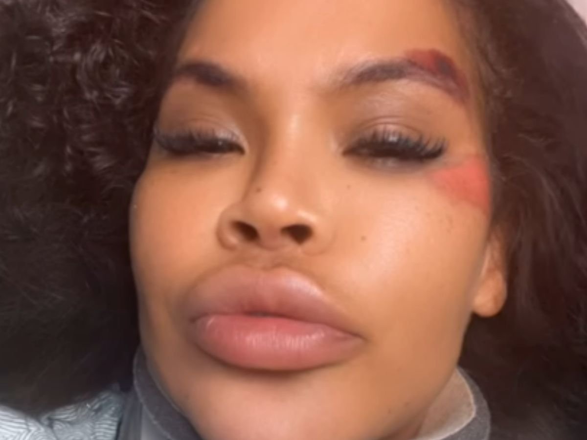 Carro destruído, colar cervical, hematomas e abandono na pista. Uma noite de terror para a ex-Big Brother!