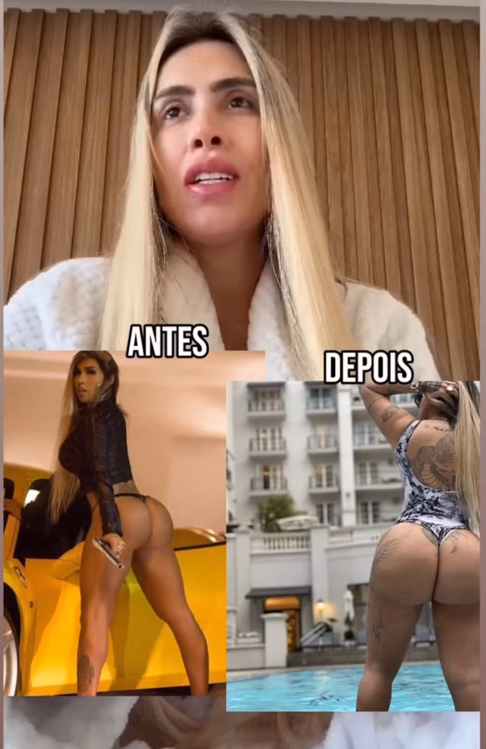 Grávida de seis meses, modelo luta contra complicações sérias do produto proibido e expõe drama nas redes sociais.