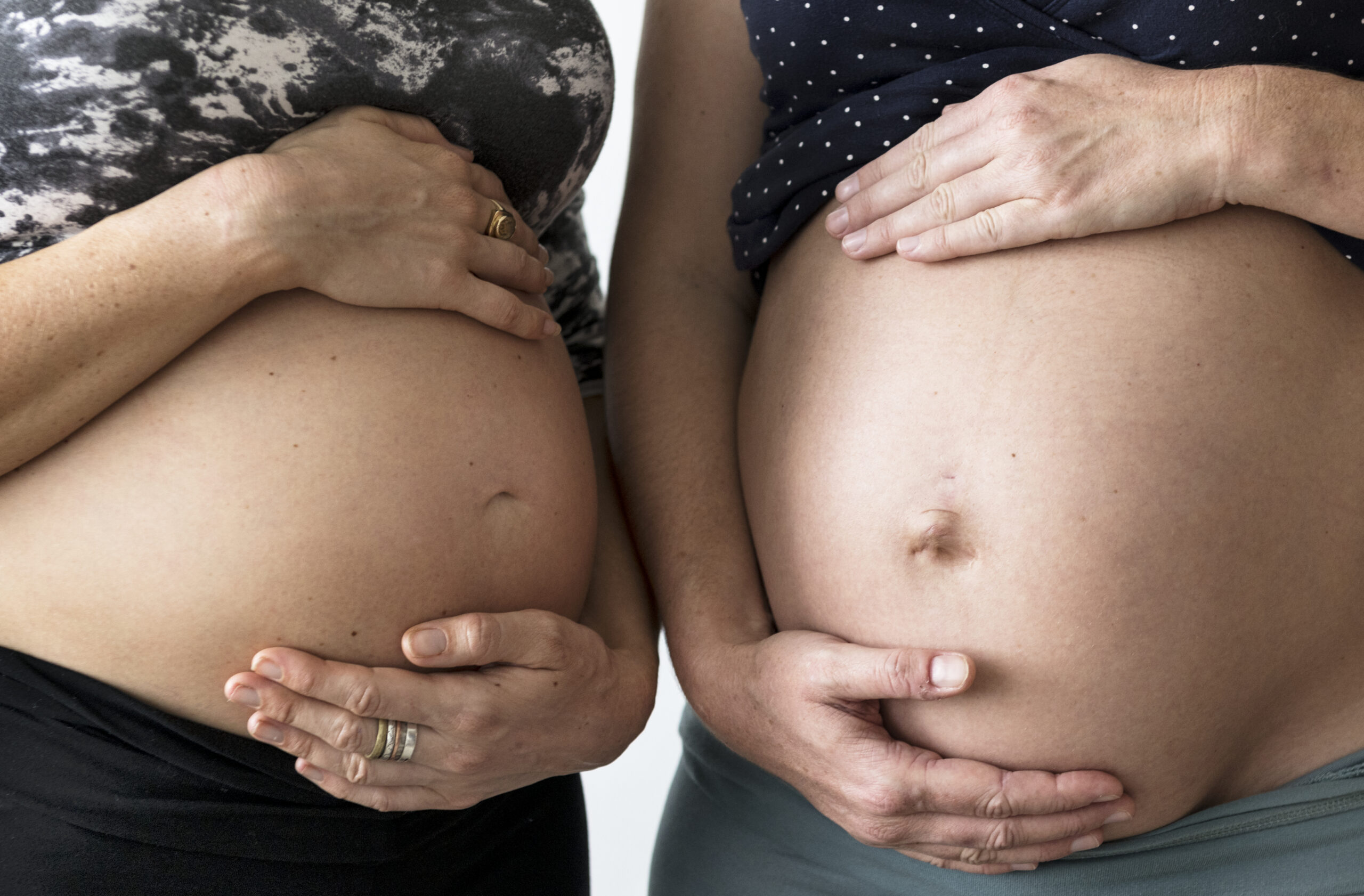 pregnant women showing their bumps
